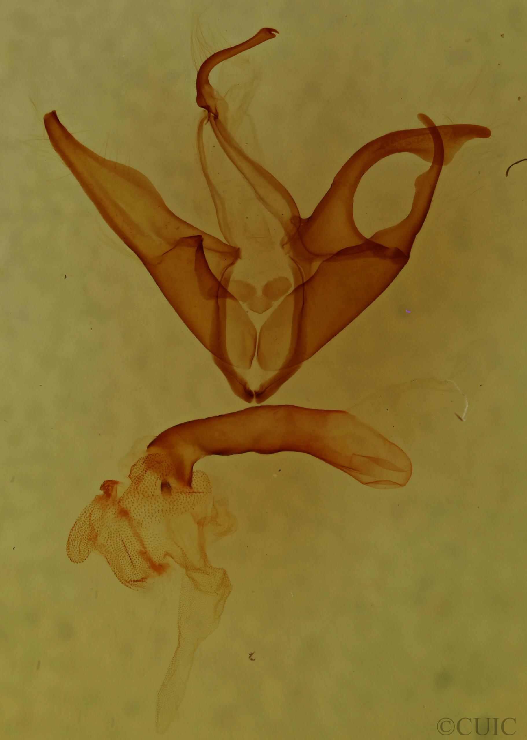 genitalia view of adult Matigramma emmilta