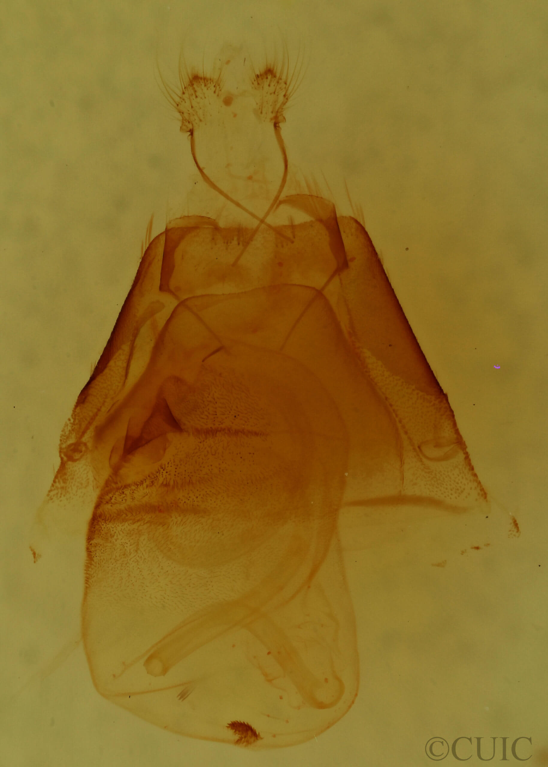 genitalia view of adult Matigramma emmilta