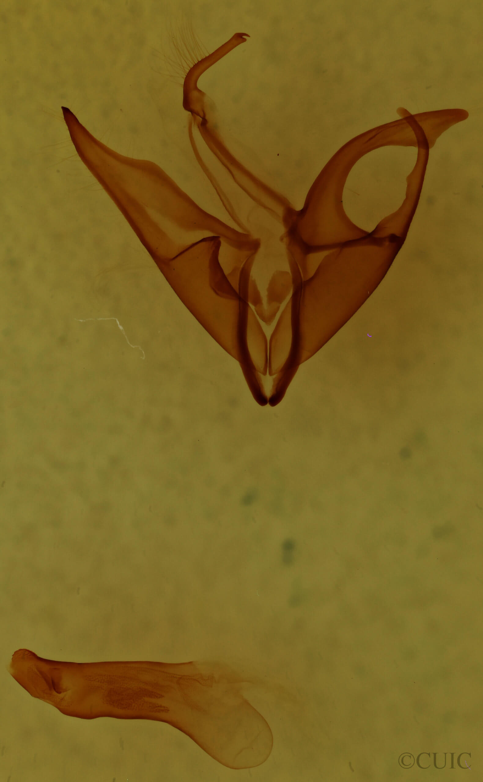 genitalia view of adult Matigramma emmilta