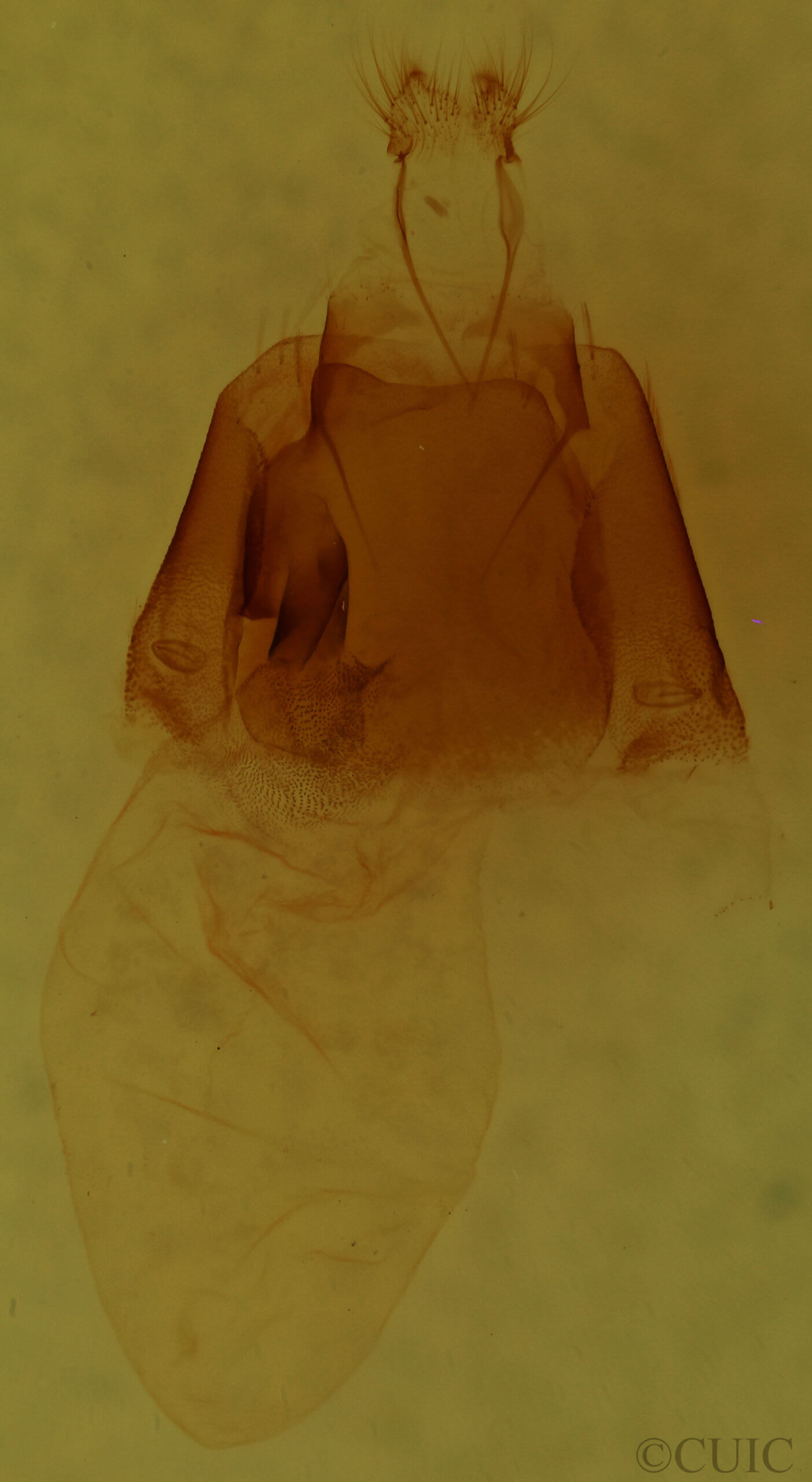 genitalia view of adult Matigramma repentina