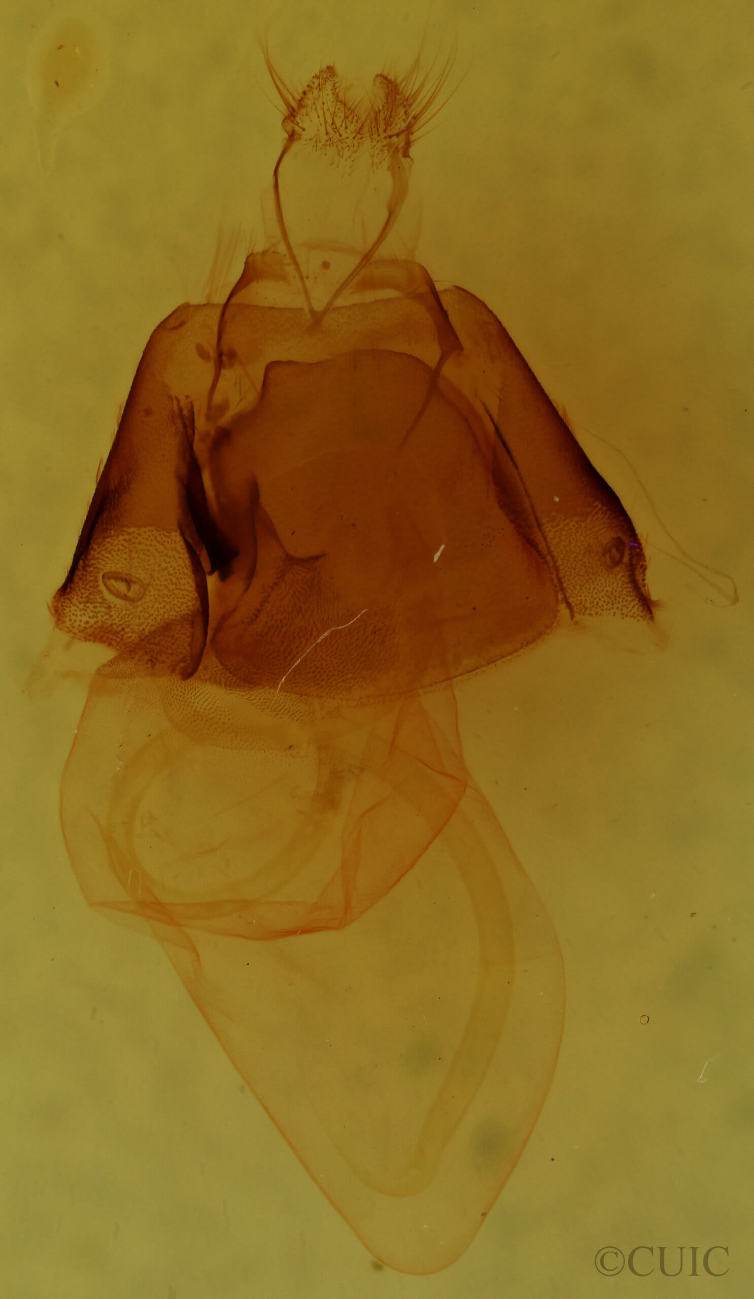 genitalia view of adult Matigramma repentina