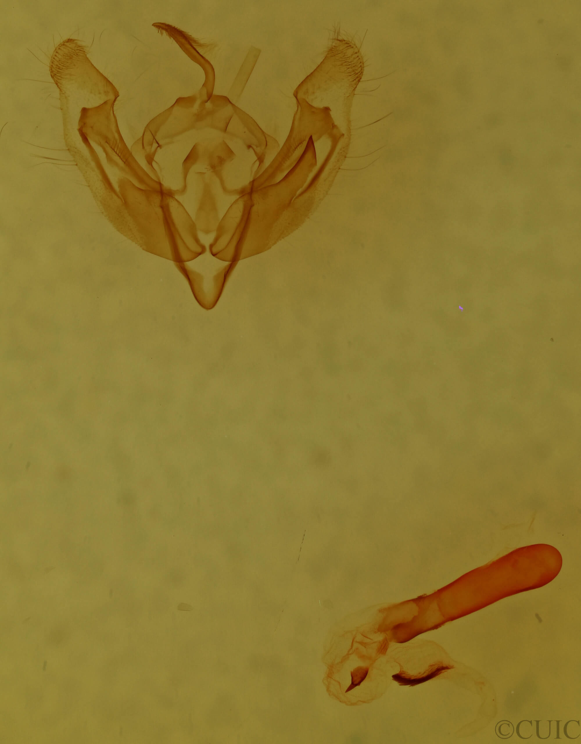 genitalia view of adult Miodera stigmata