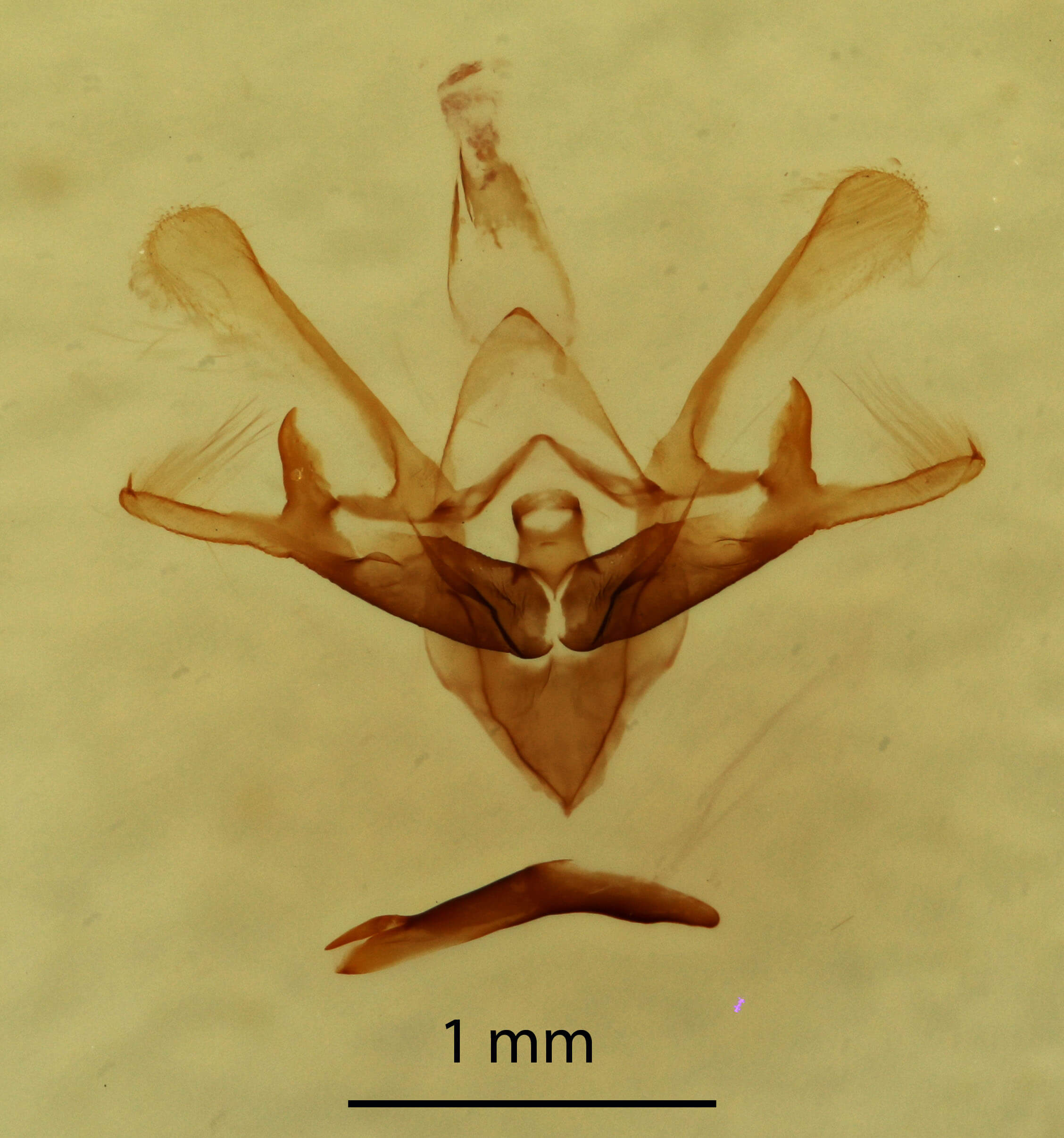 genitalia view of adult Nola cucullatella