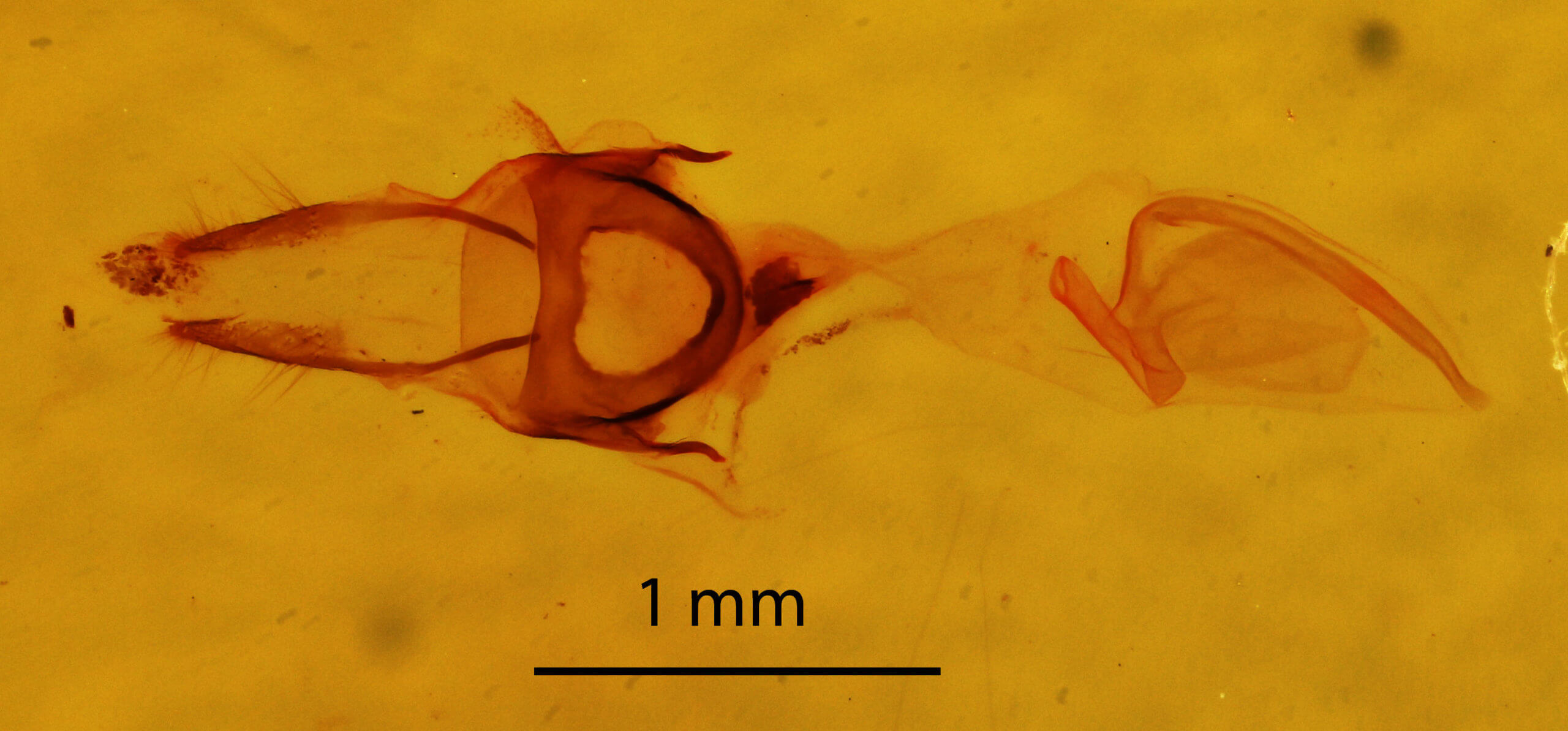 genitalia view of adult Nola cucullatella