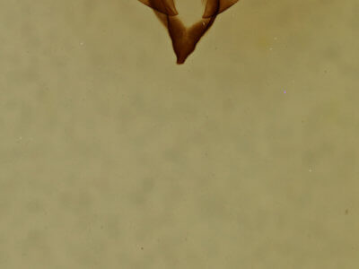 genitalia view of adult Nola cilicoides