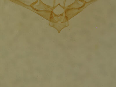 genitalia view of adult Nola ovilla