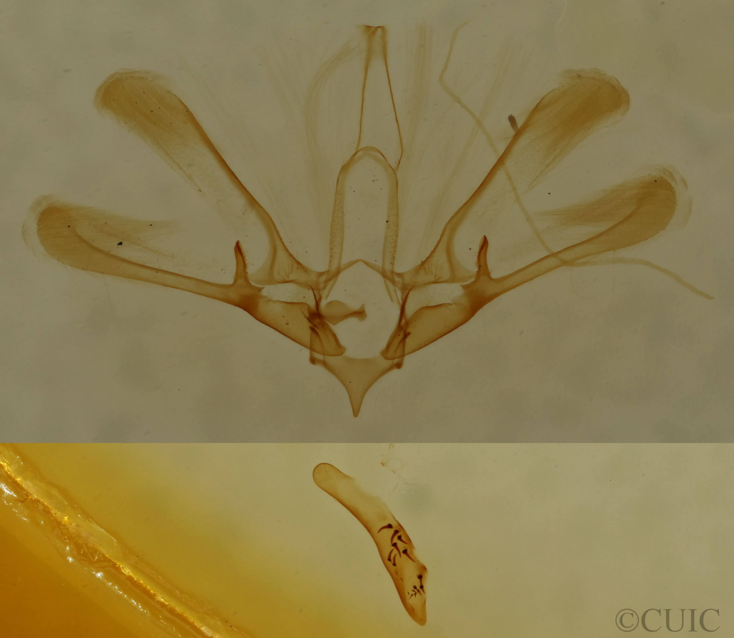 genitalia view of adult Nola triquetrana