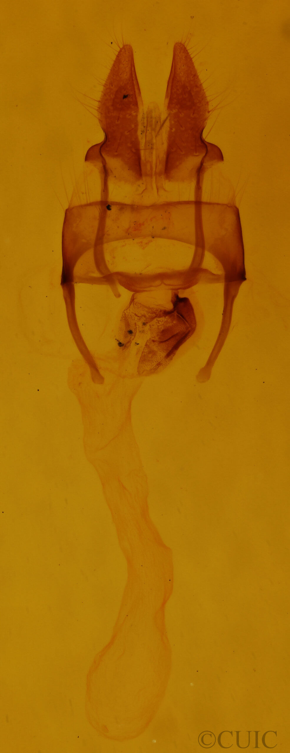 genitalia view of adult Oligia chlorostigma