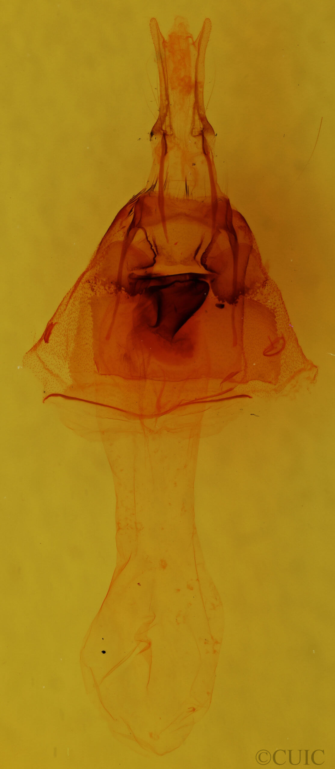 genitalia view of adult Oligia divesta