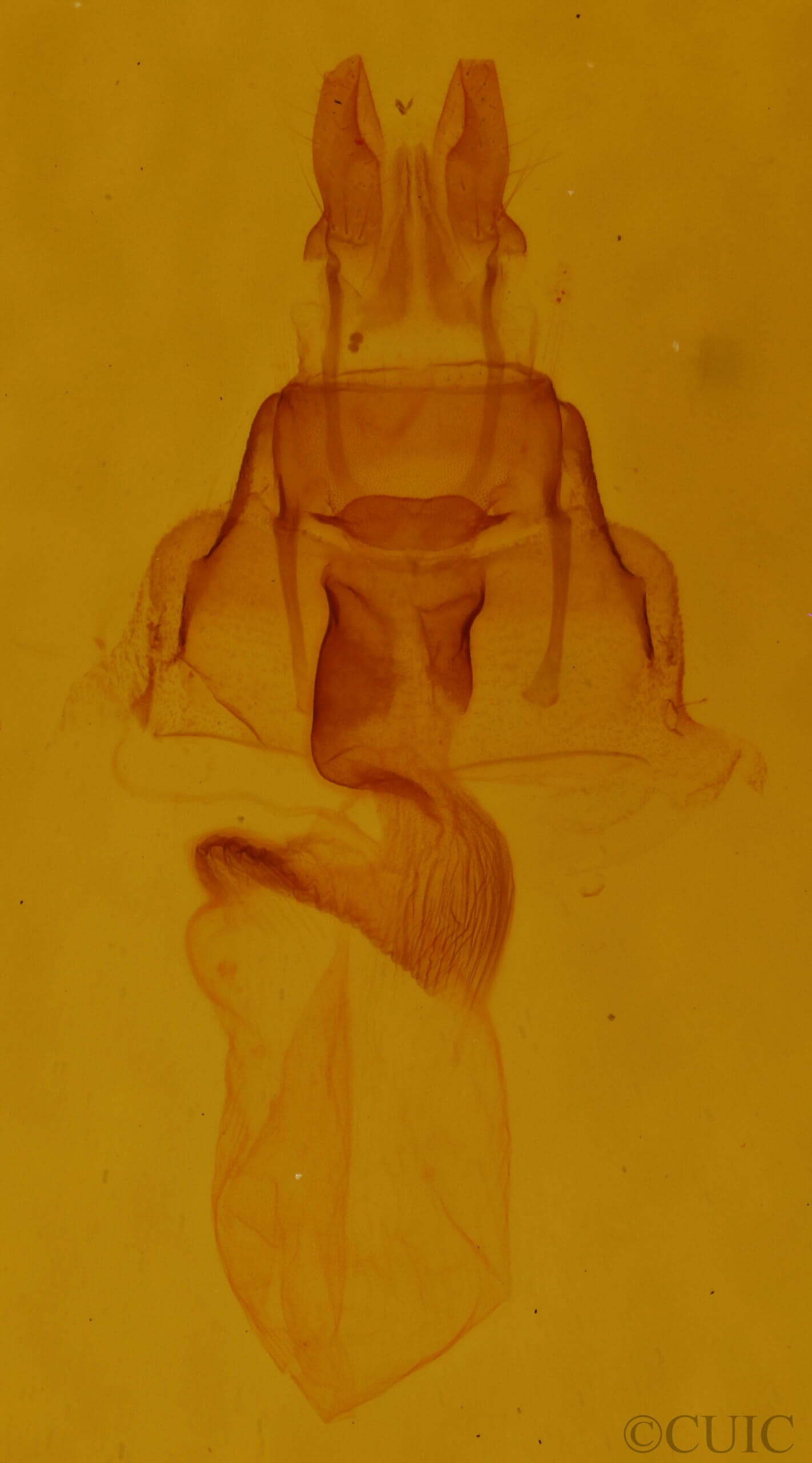 genitalia view of adult Neoligia exhausta