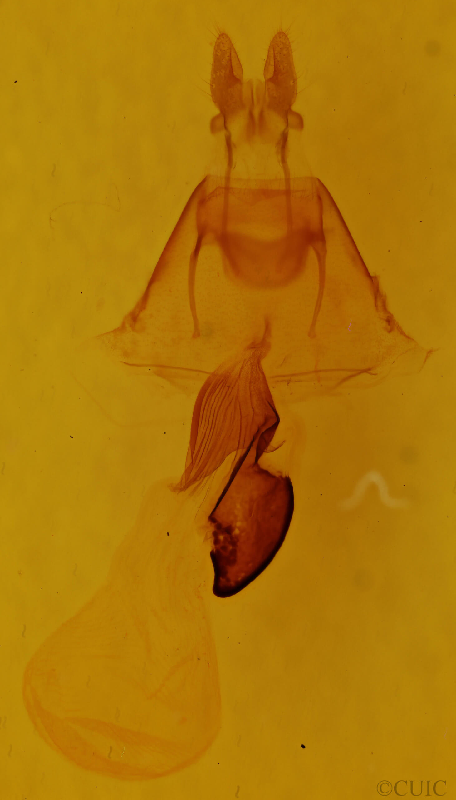 genitalia view of adult Oligia modica