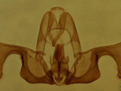 genitalia view of adult Retinia