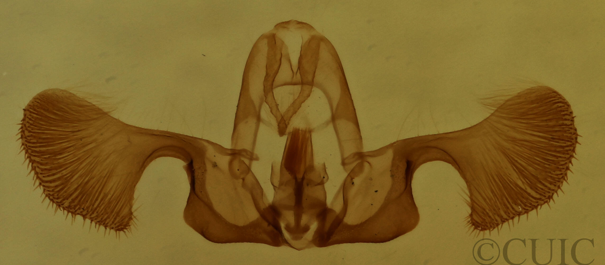 genitalia view of adult Retinia