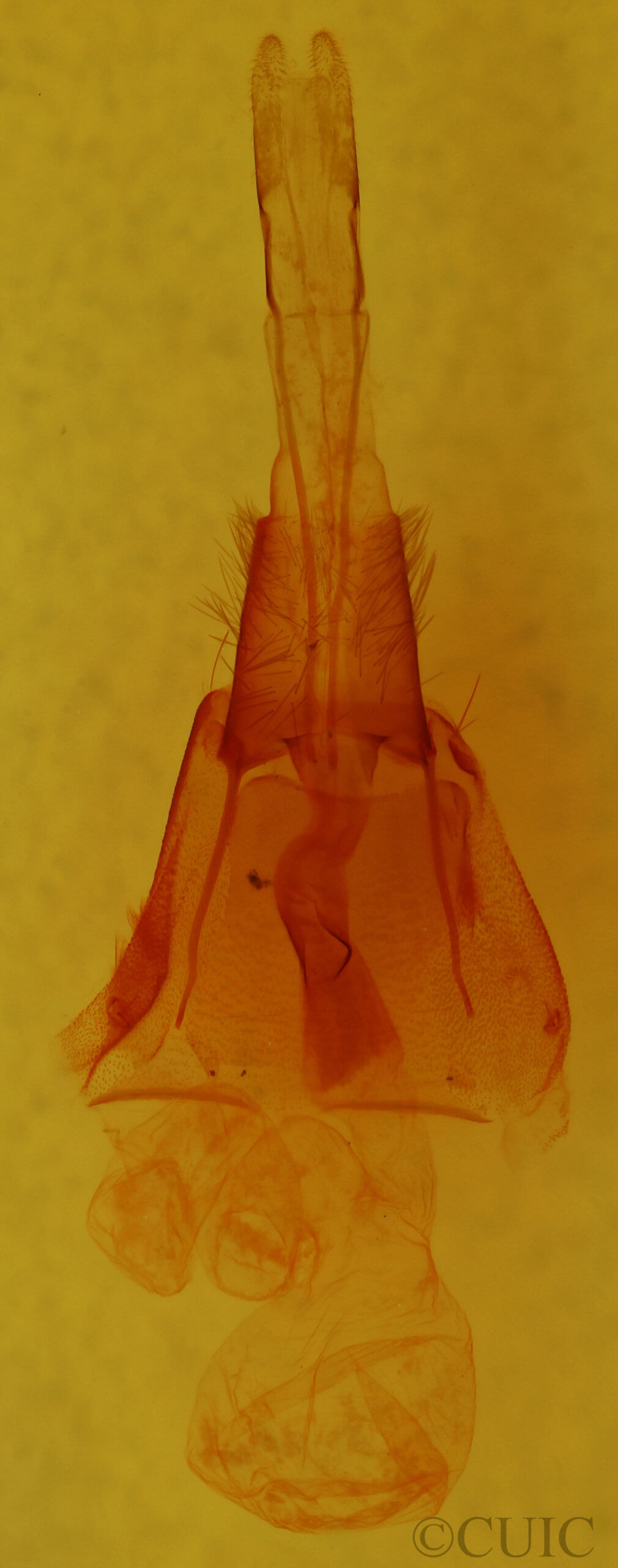 genitalia view of adult Protorthodes alfkeni