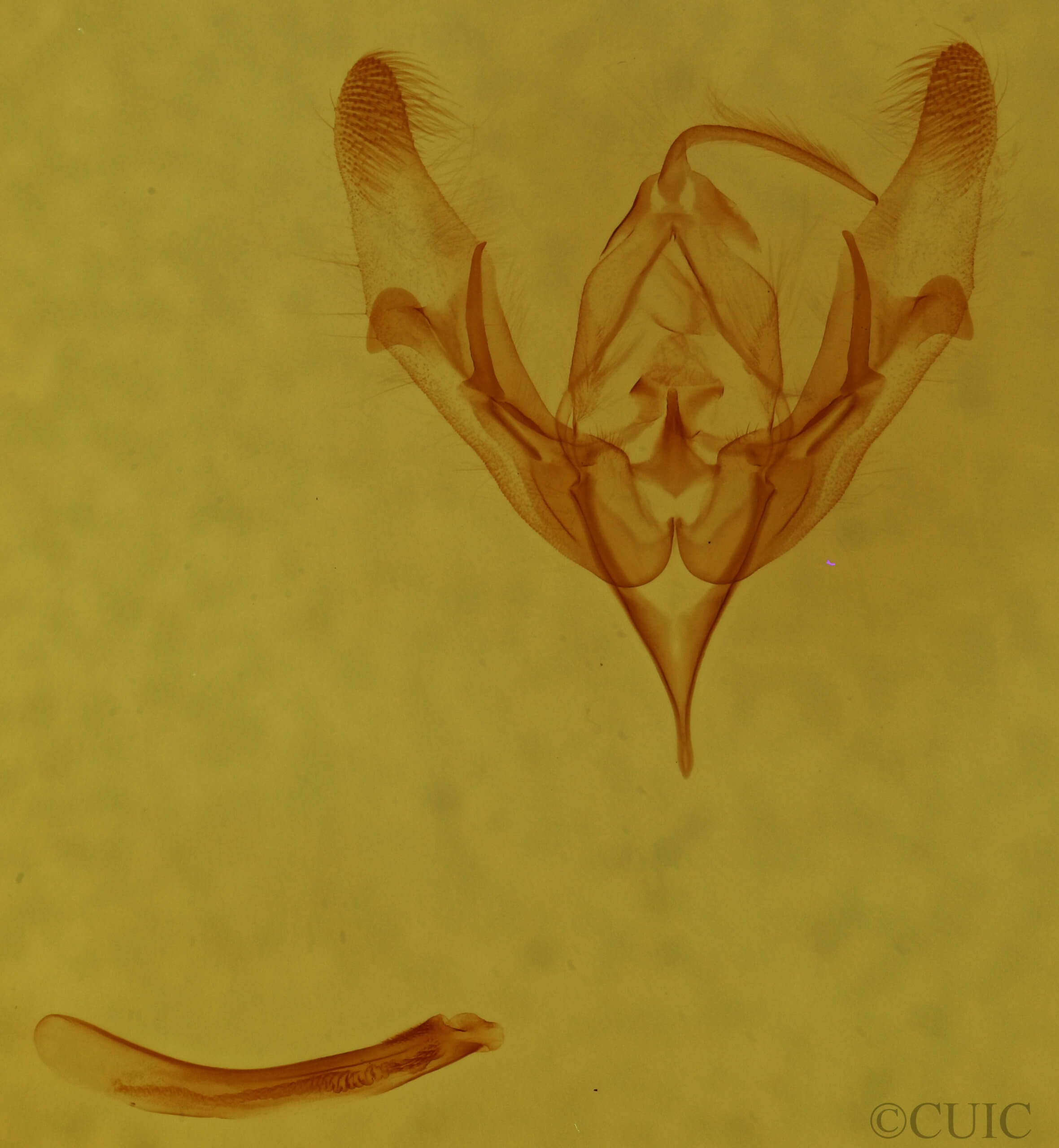 genitalia view of adult Protorthodes antennata