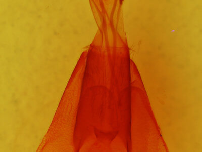 genitalia view of adult Protorthodes antennata