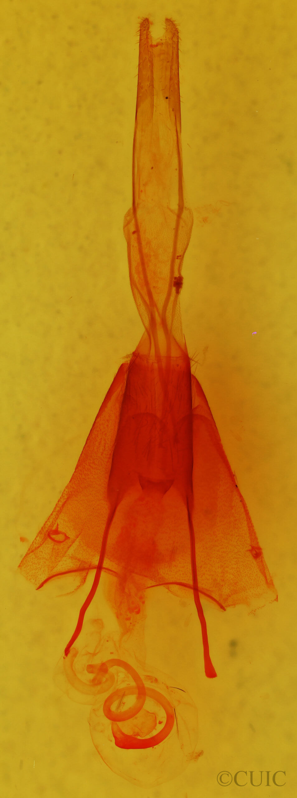 genitalia view of adult Protorthodes antennata