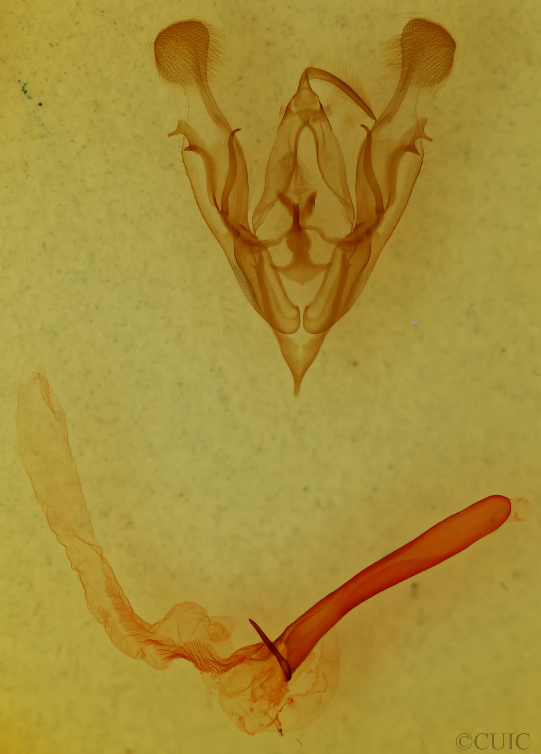 genitalia view of adult Protorthodes mulina