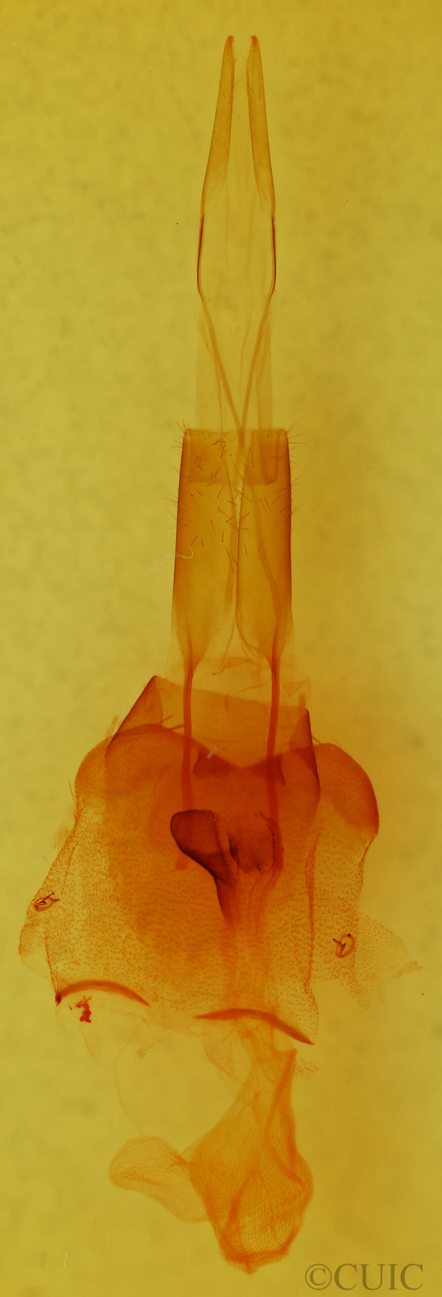 genitalia view of adult Protorthodes mulina