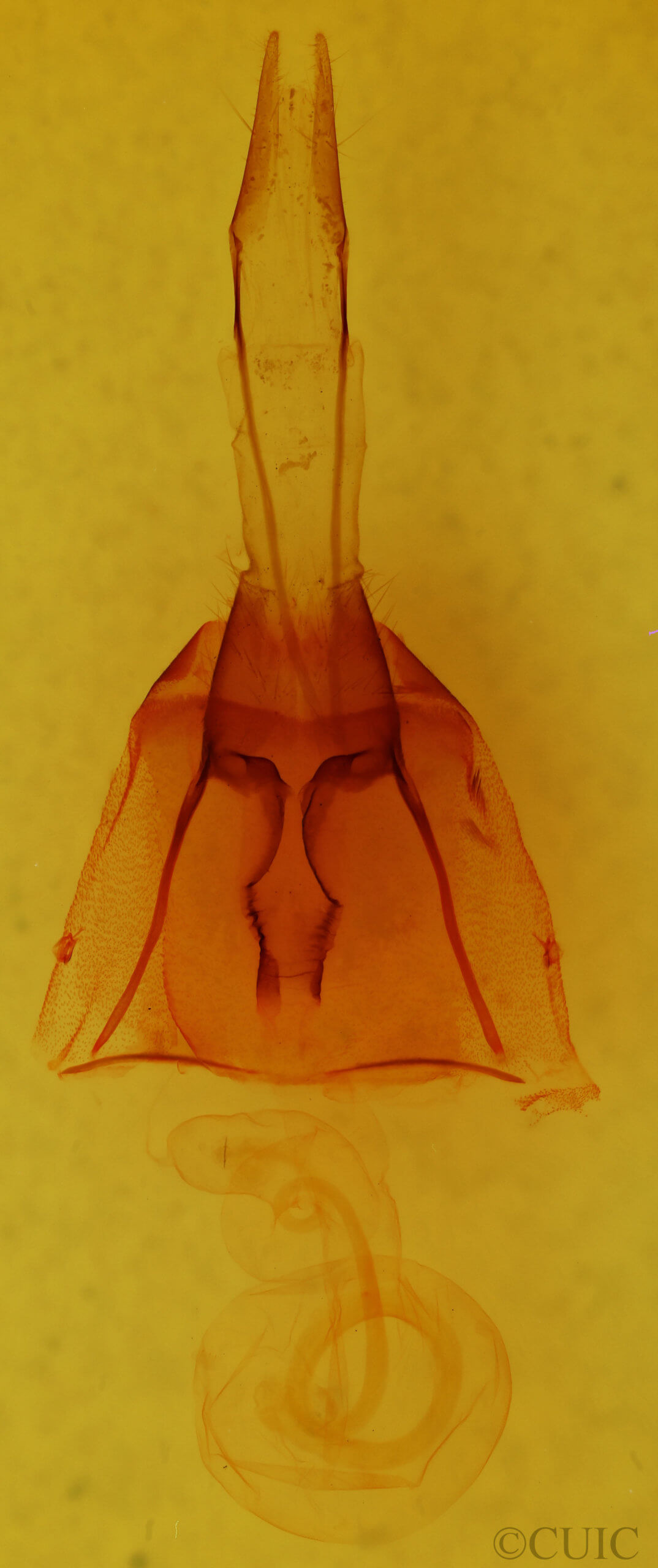 genitalia view of adult Protorthodes oviduca