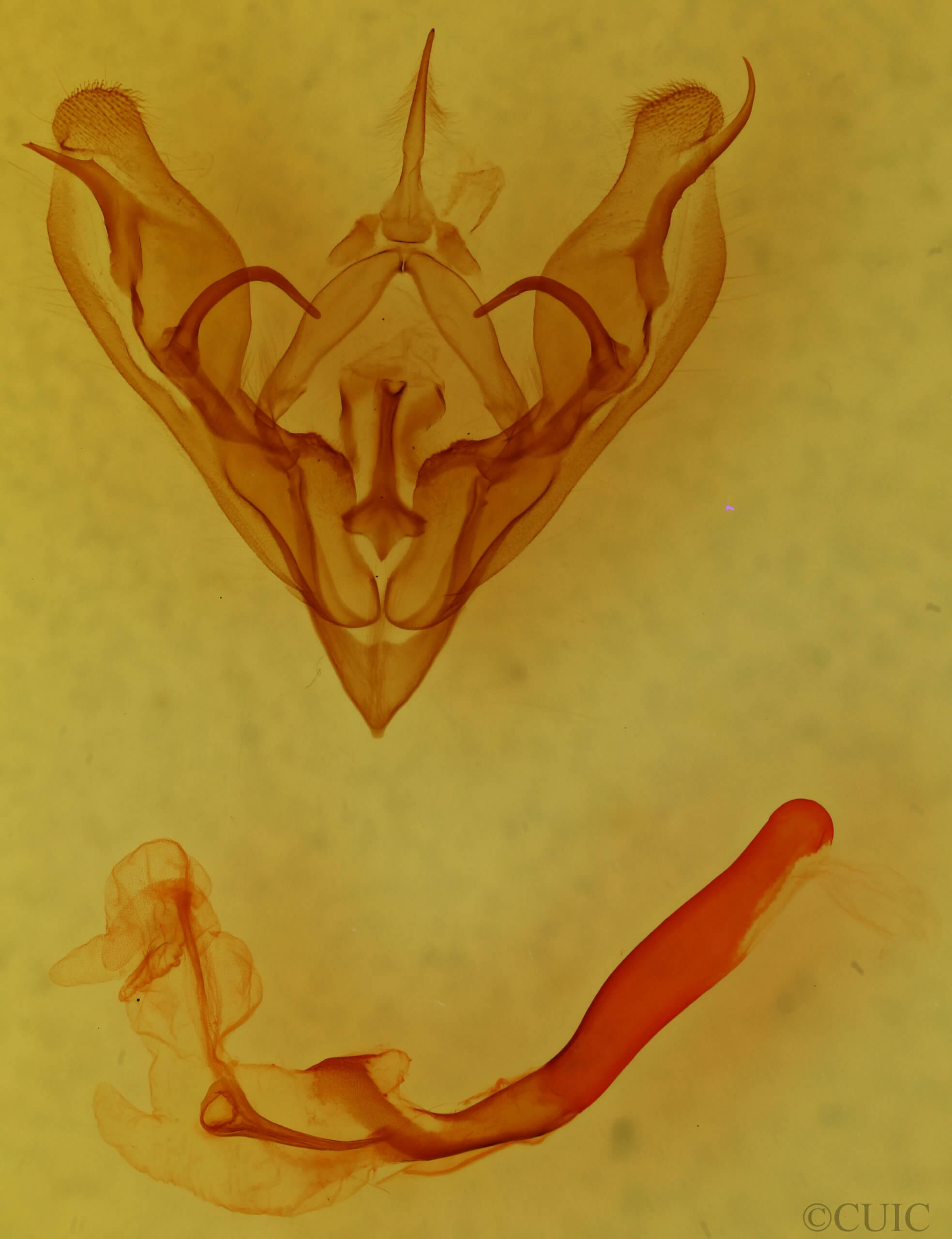 genitalia view of adult Protorthodes rufula