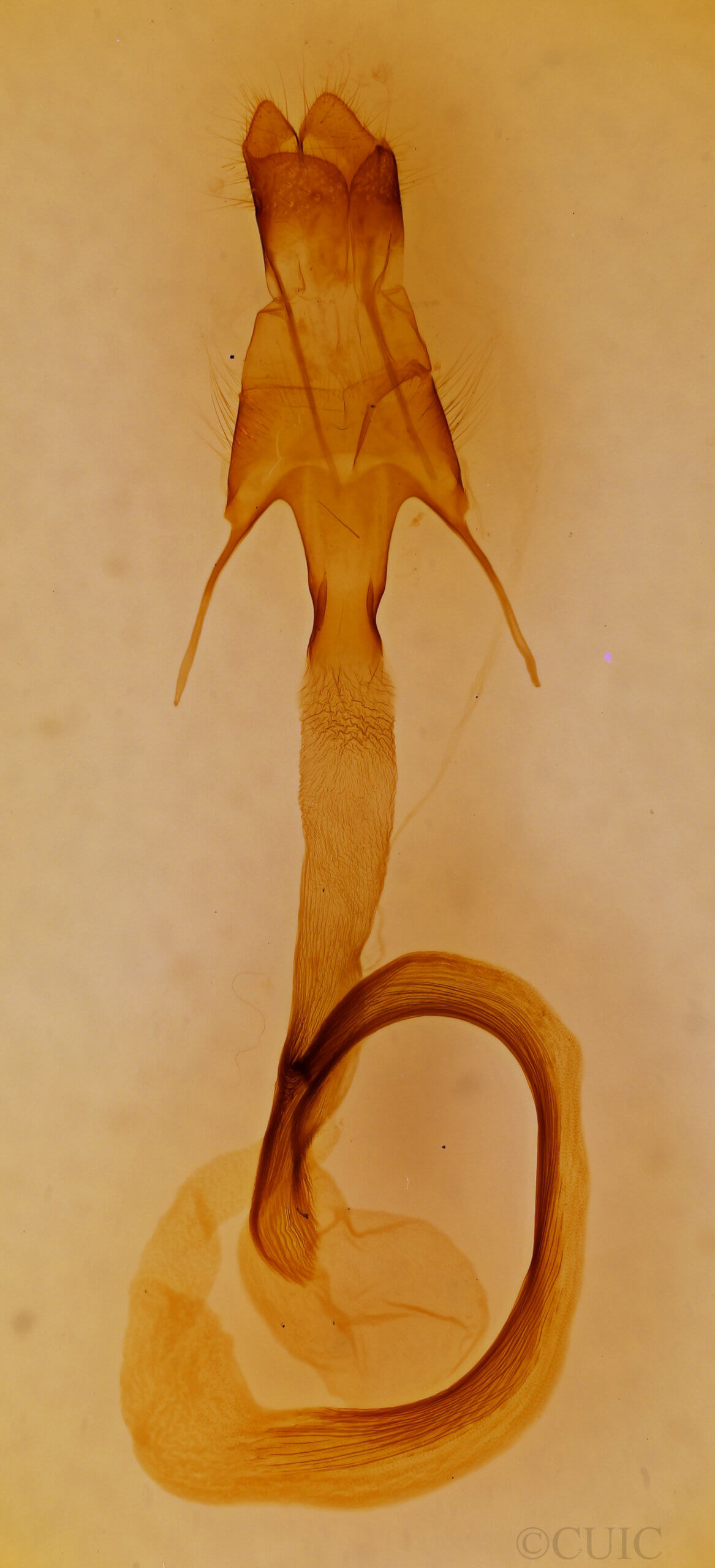 genitalia view of adult Mythimna albicosta