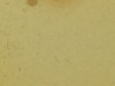 genitalia view of adult Pseudorthodes