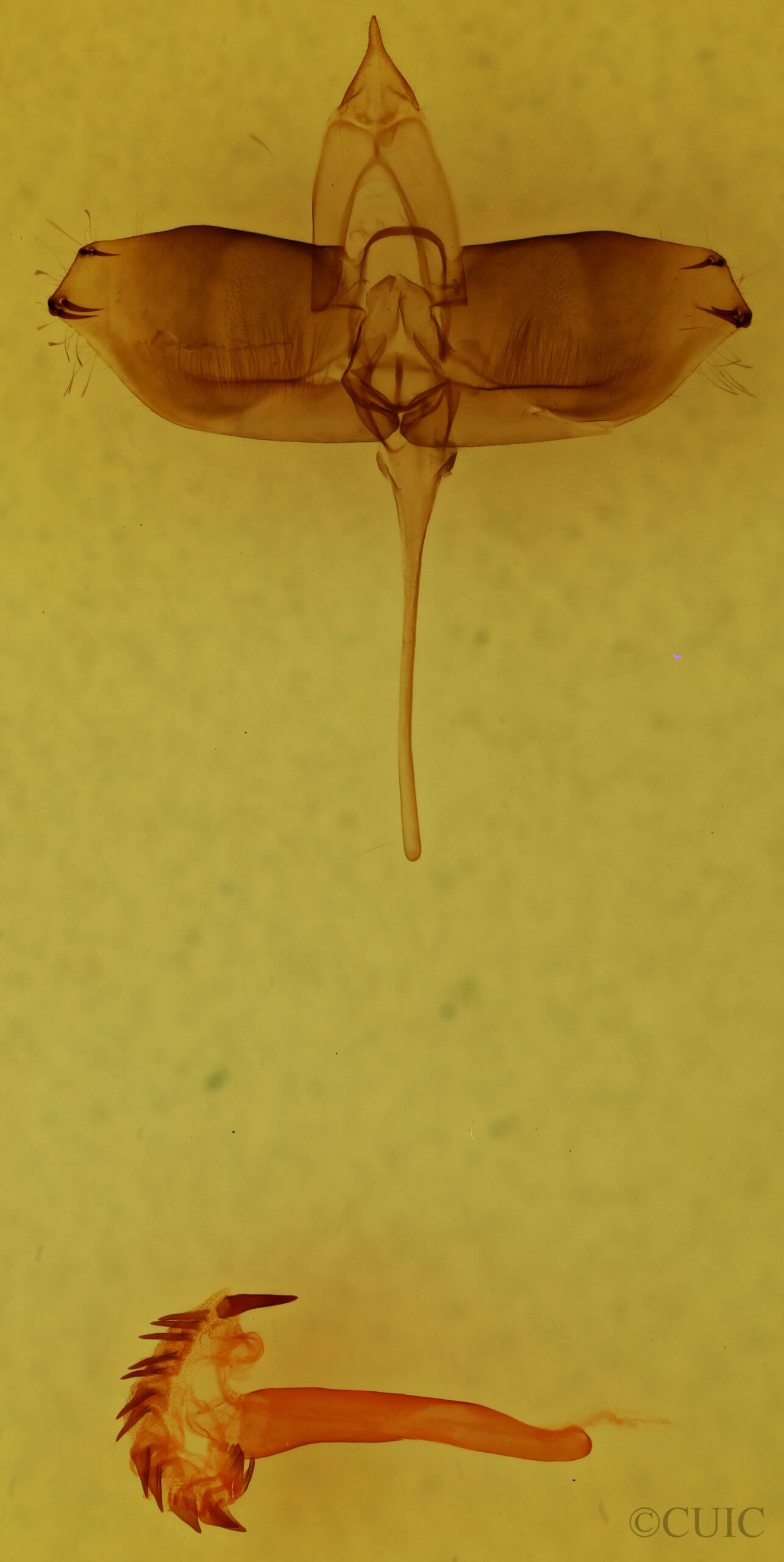 genitalia view of adult Sphacelodes vulneraria