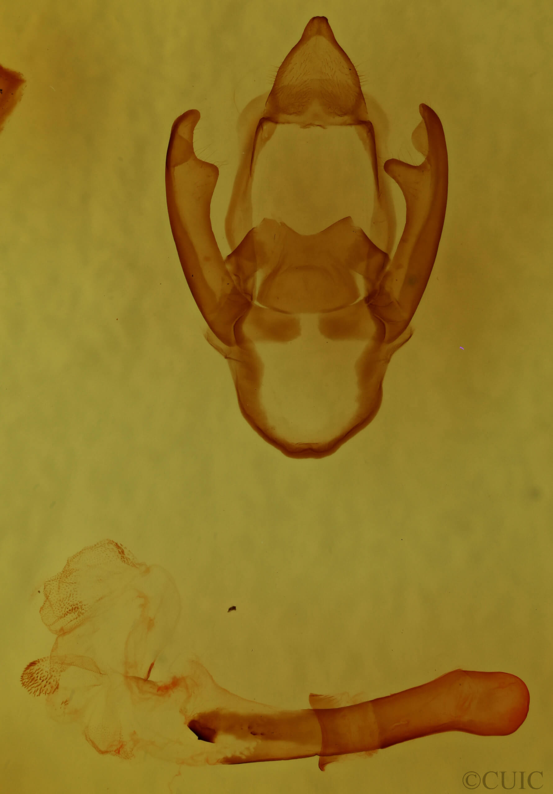 genitalia view of adult Spilosoma dubia