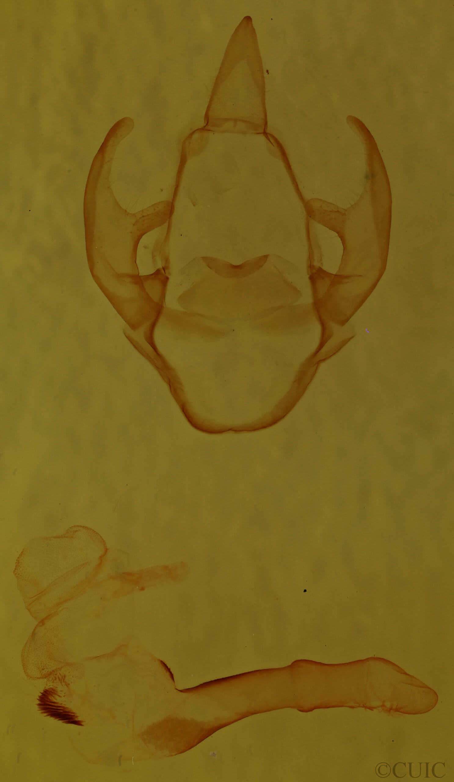 genitalia view of adult Spilosoma latipennis