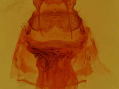 genitalia view of adult Antaeotricha leucillana