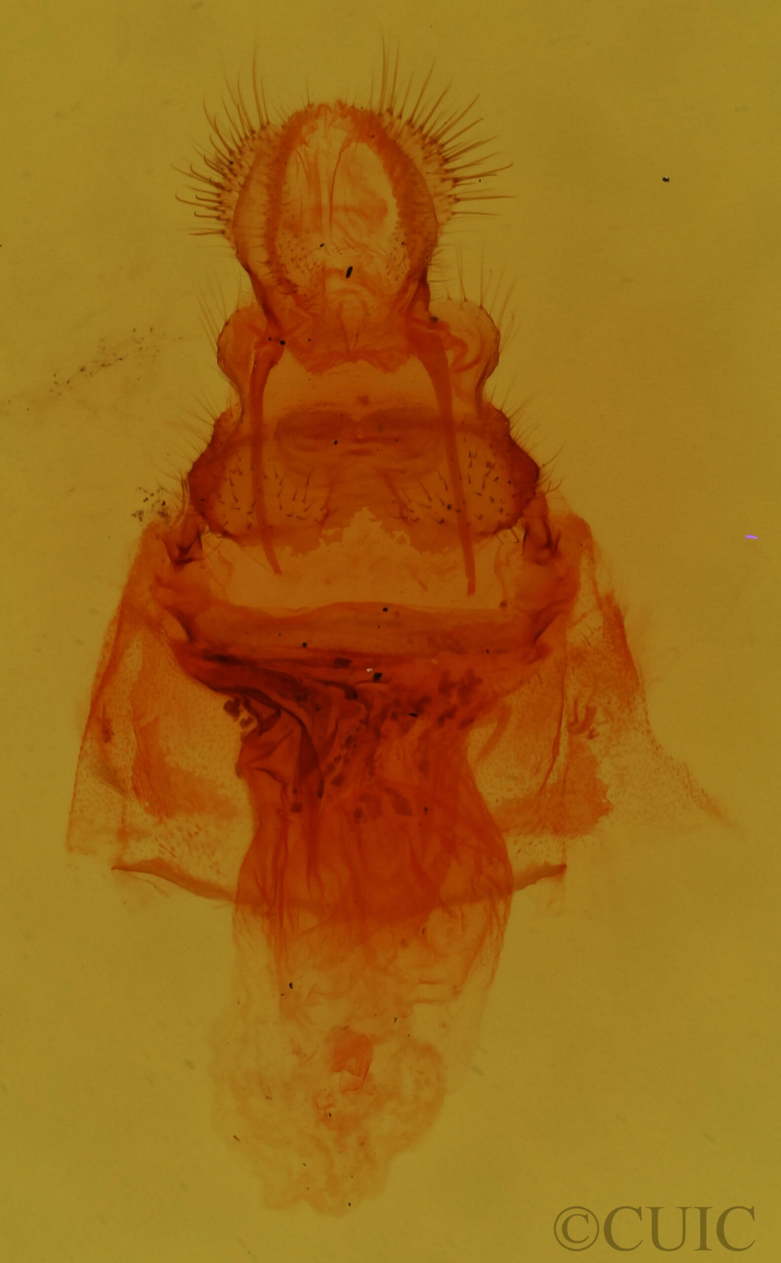genitalia view of adult Antaeotricha leucillana