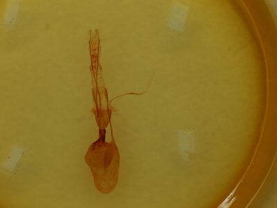 genitalia view of adult Telorta edentata