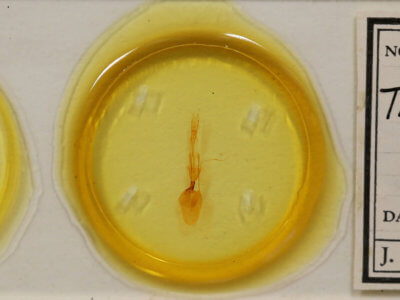 slide view of adult Telorta edentata