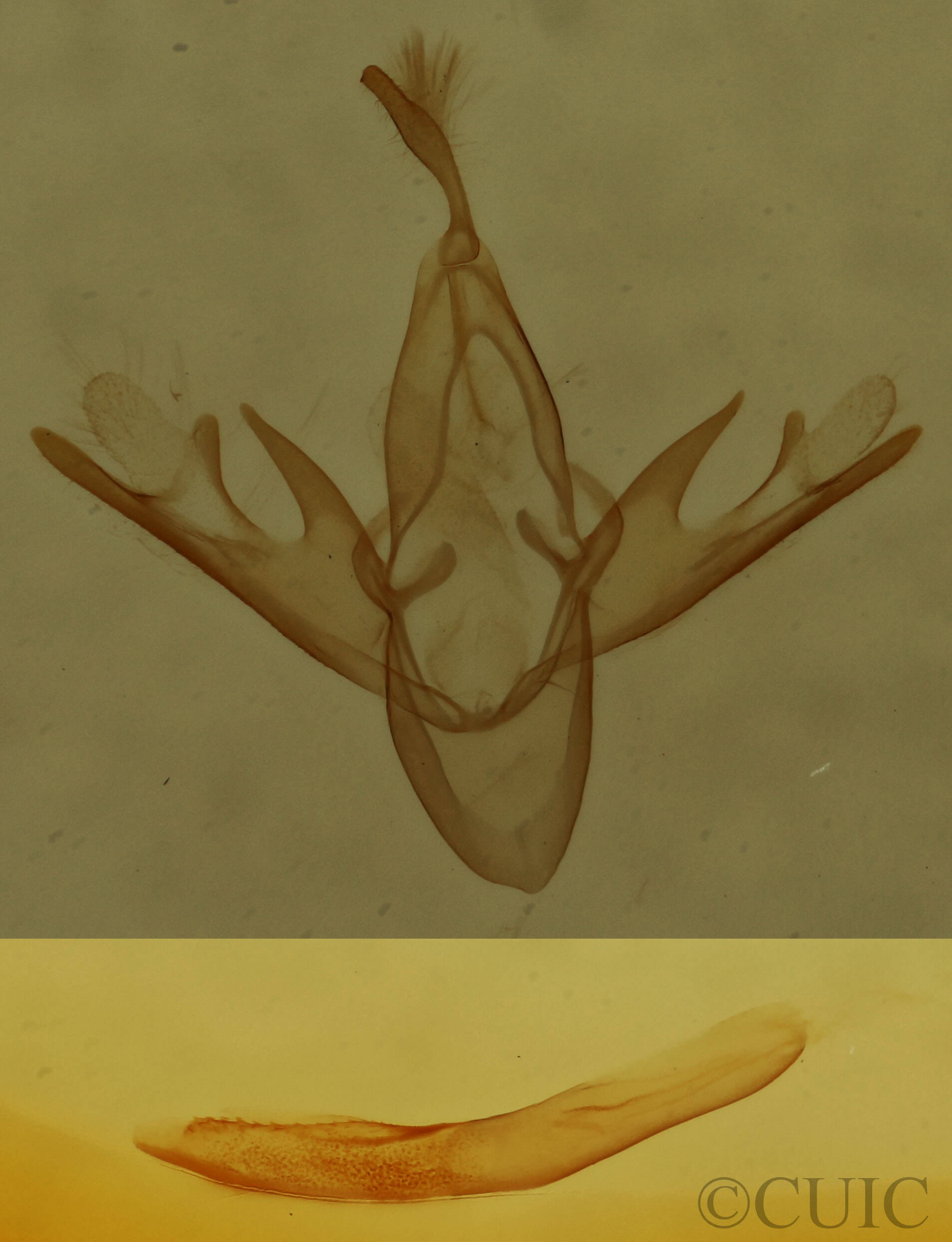 genitalia view of adult Tetanolita