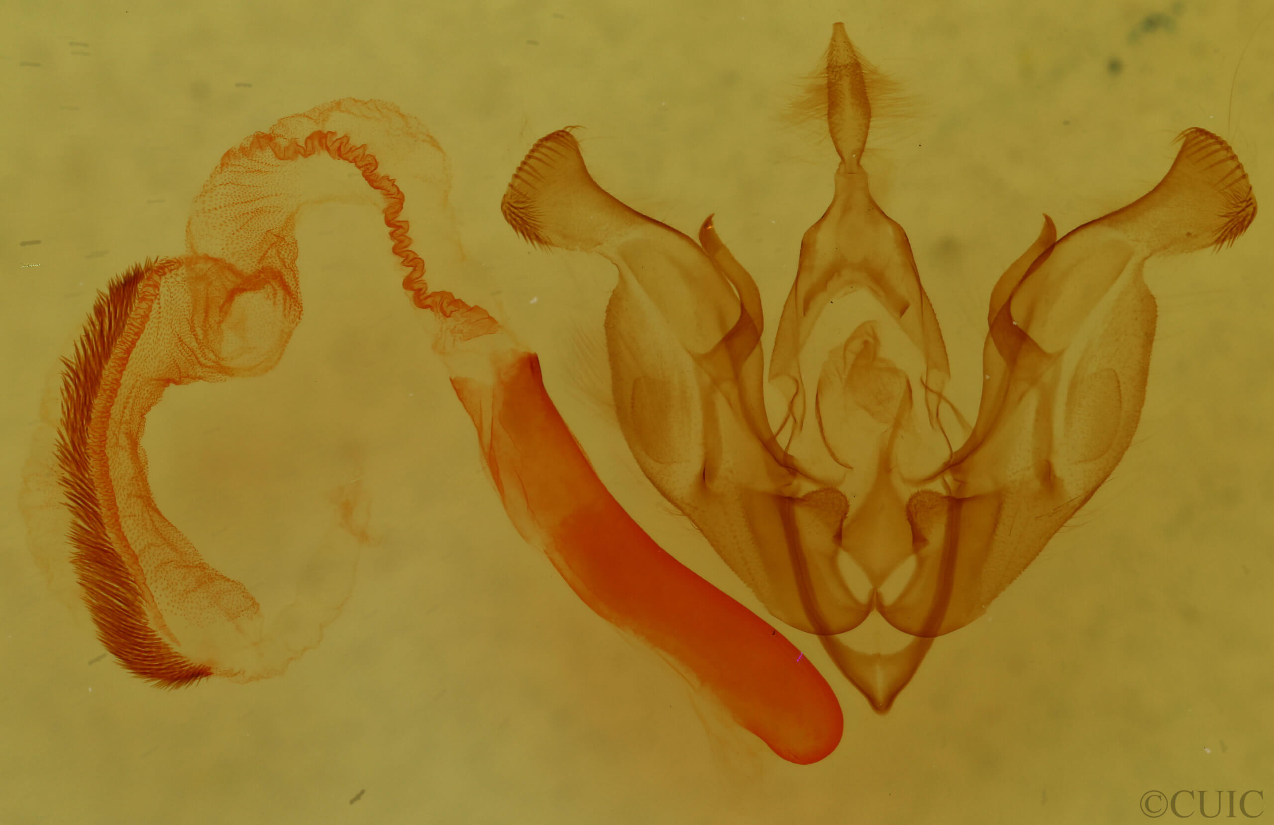 genitalia view of adult Trichocerapoda comstocki