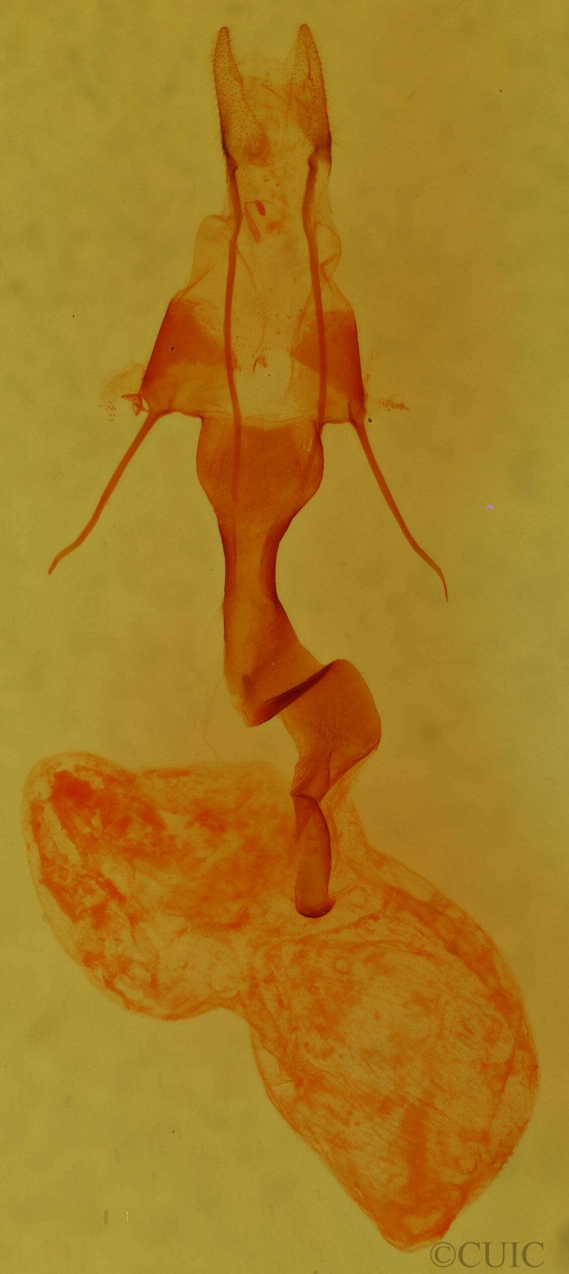 genitalia view of adult Trichocerapoda comstocki