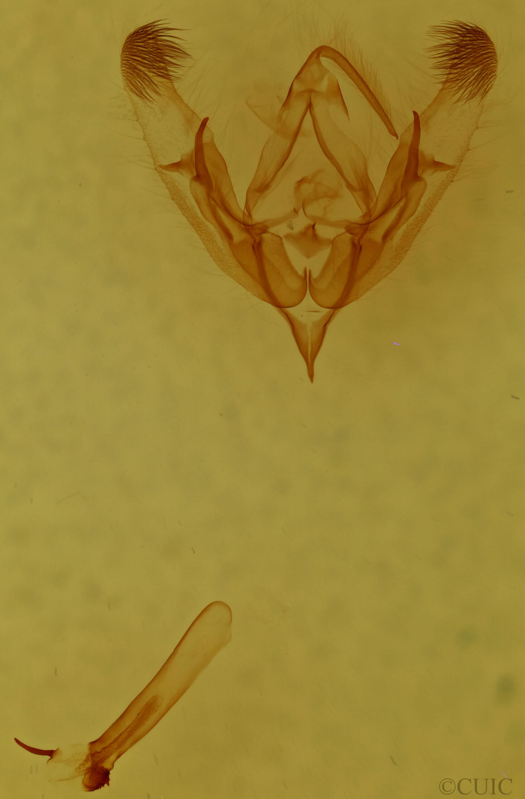 genitalia view of adult Trichopolia dentatella