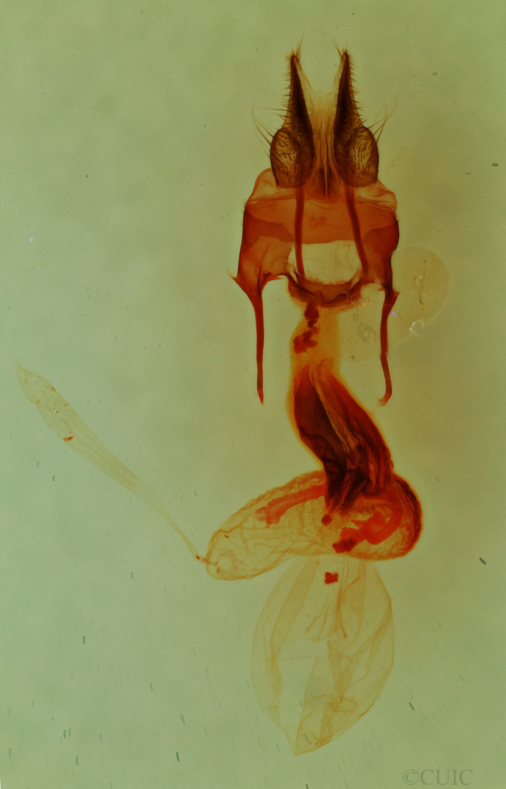 genitalia view of adult Hypotrix naglei