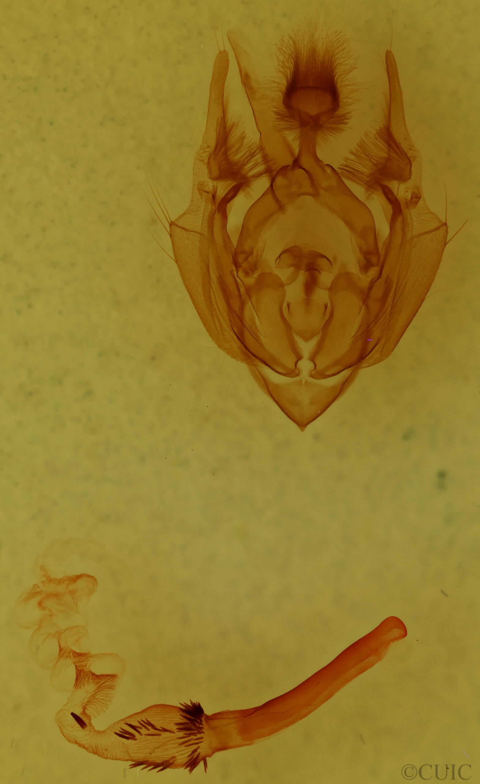 genitalia view of adult Hypotrix lunata