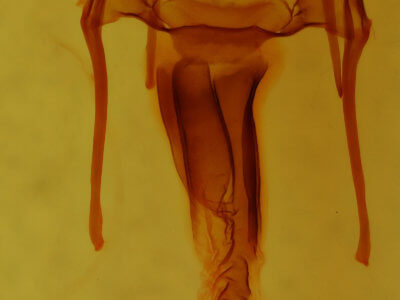 genitalia view of adult Hypotrix lunata