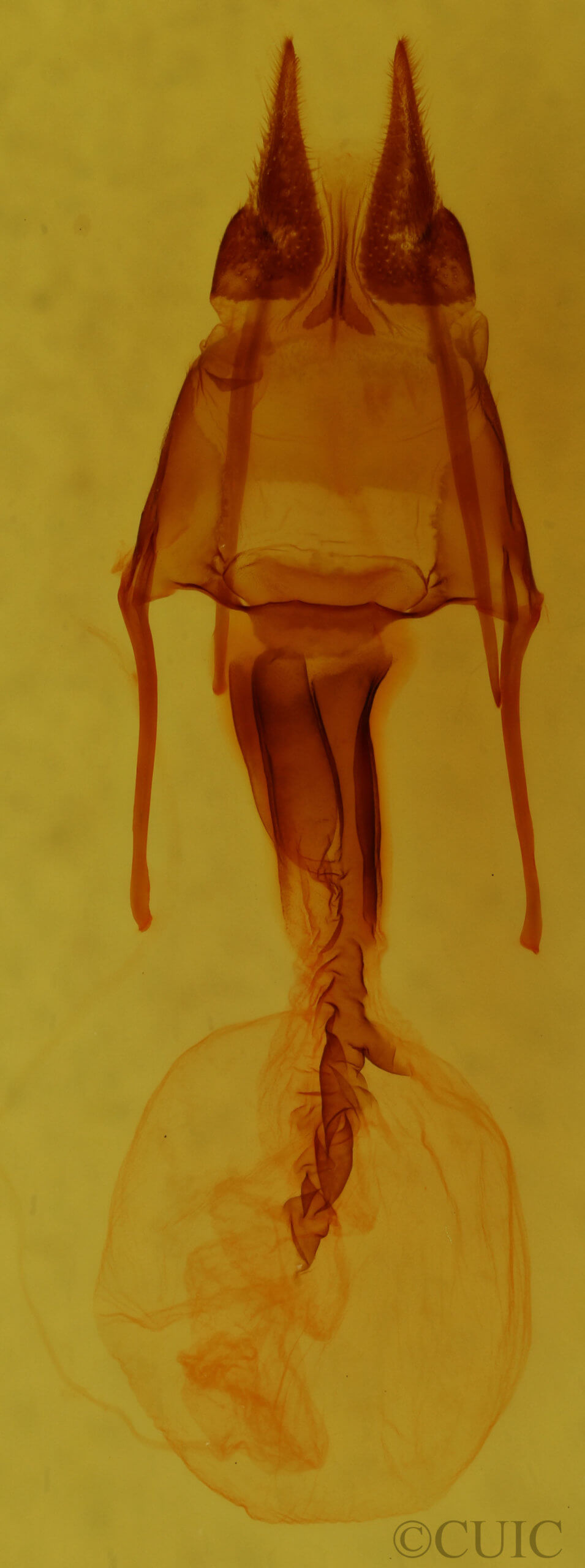 genitalia view of adult Hypotrix lunata