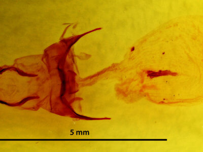 genitalia view of adult Xanthopastis regnatrix