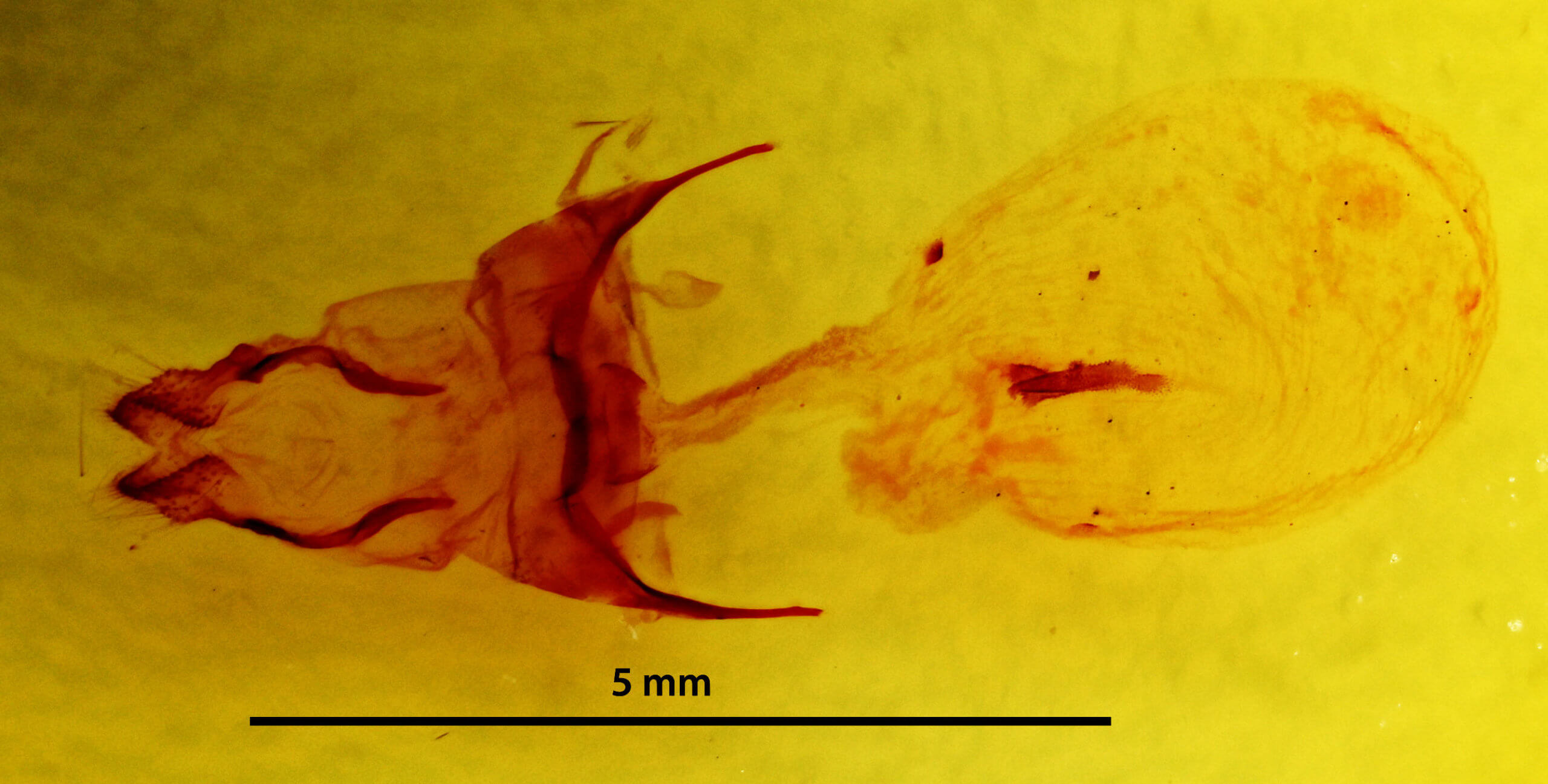 genitalia view of adult Xanthopastis regnatrix