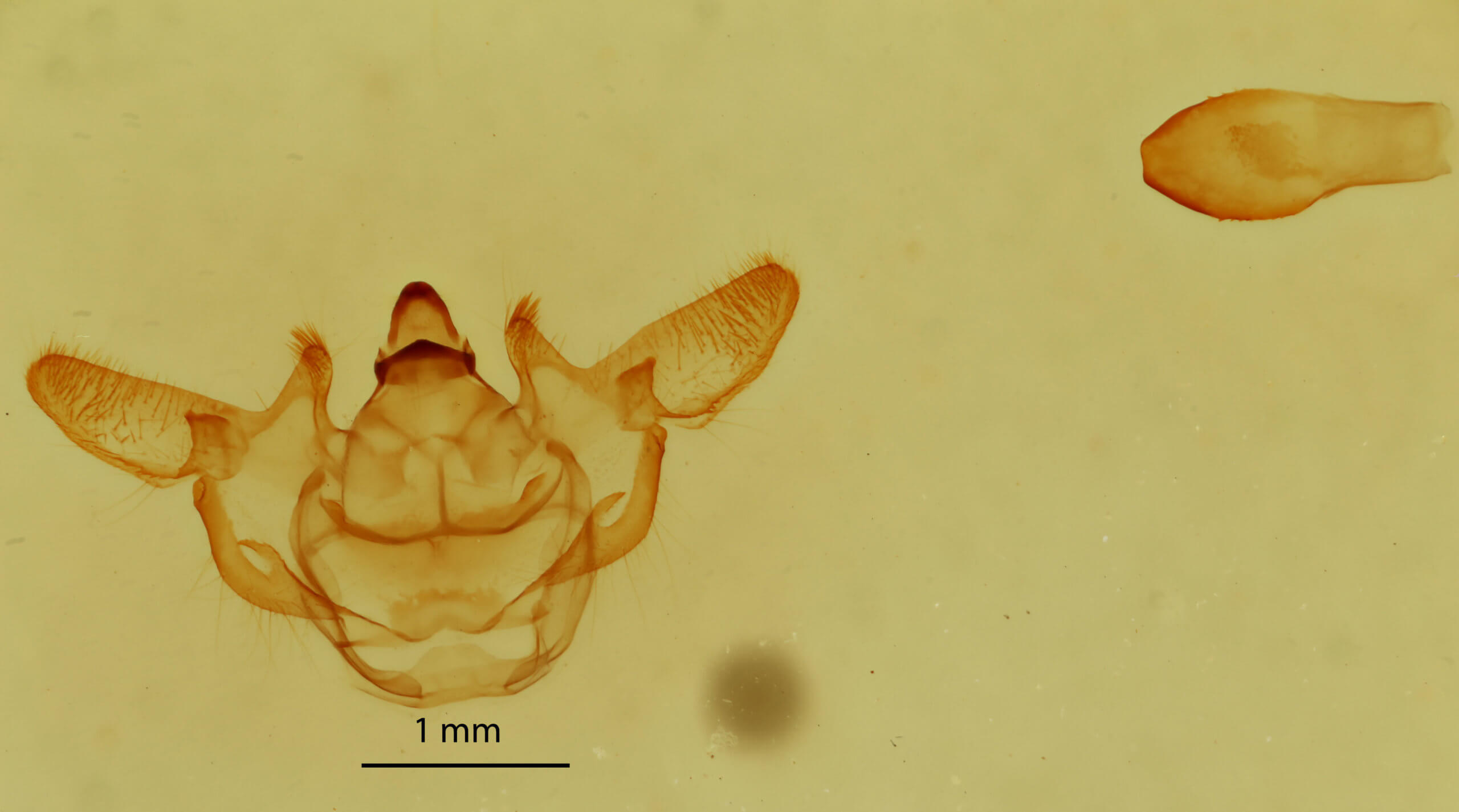 genitalia view of adult Xanthotype sospeta