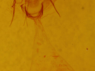 genitalia view of adult Xanthotype sospeta