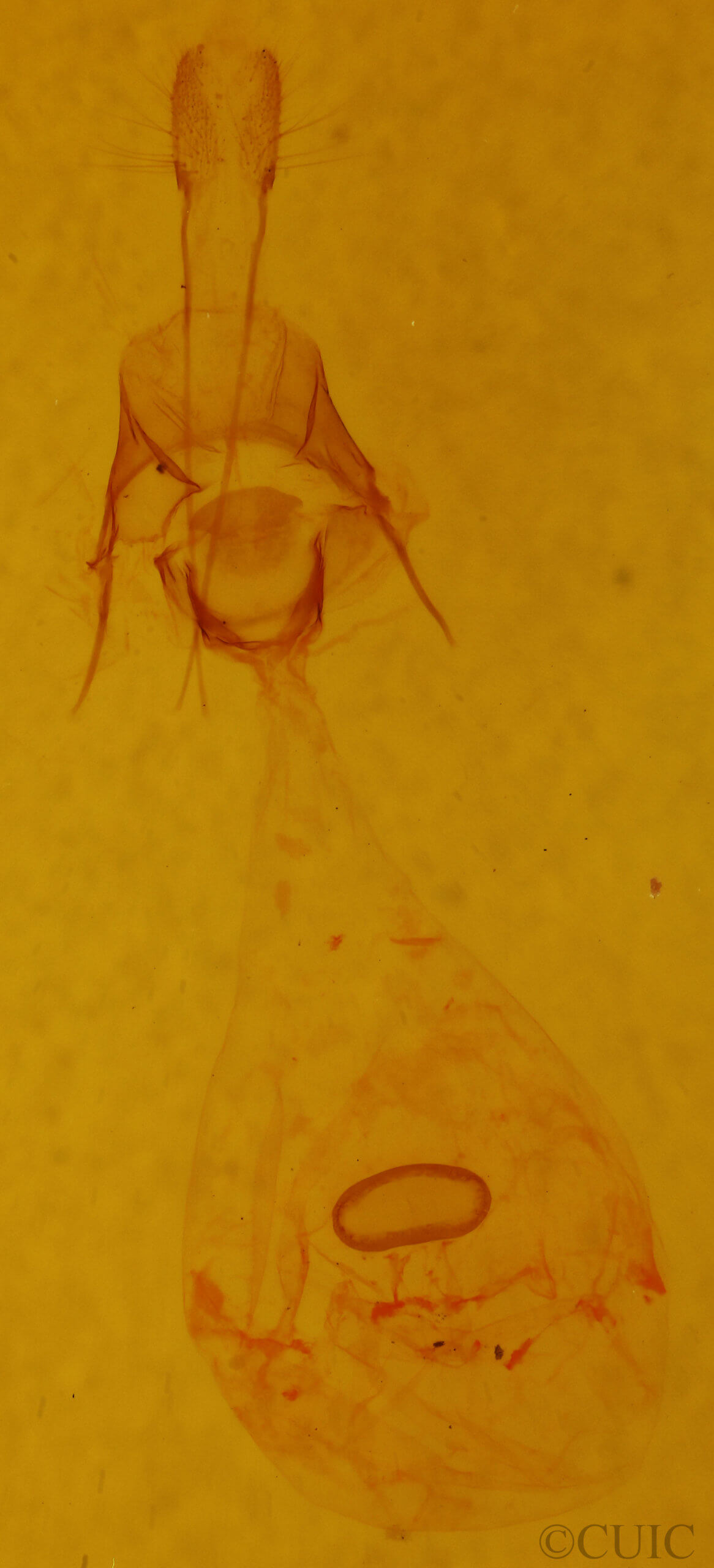 genitalia view of adult Xanthotype sospeta