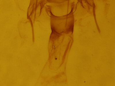 genitalia view of adult Xanthotype urticaria