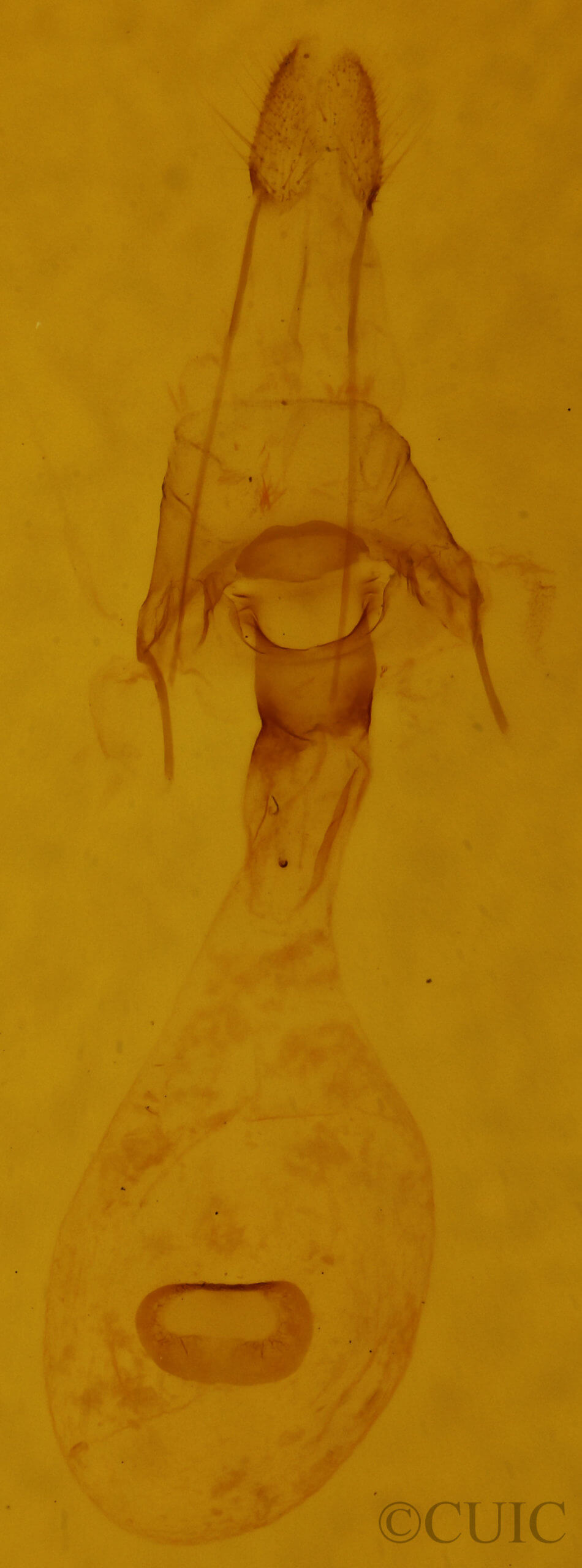 genitalia view of adult Xanthotype urticaria