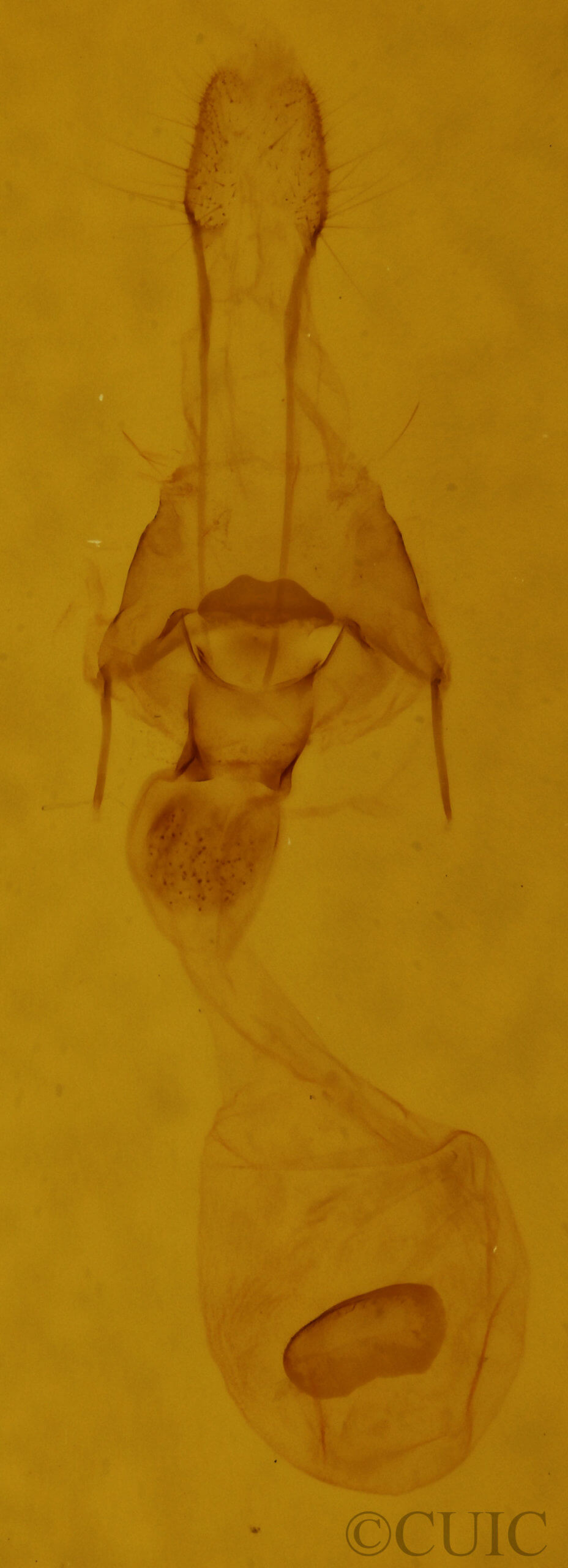 genitalia view of adult Xanthotype urticaria